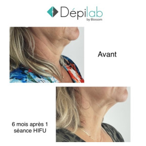DEPILAB by Blossom : Focus sur l\'anti-âge